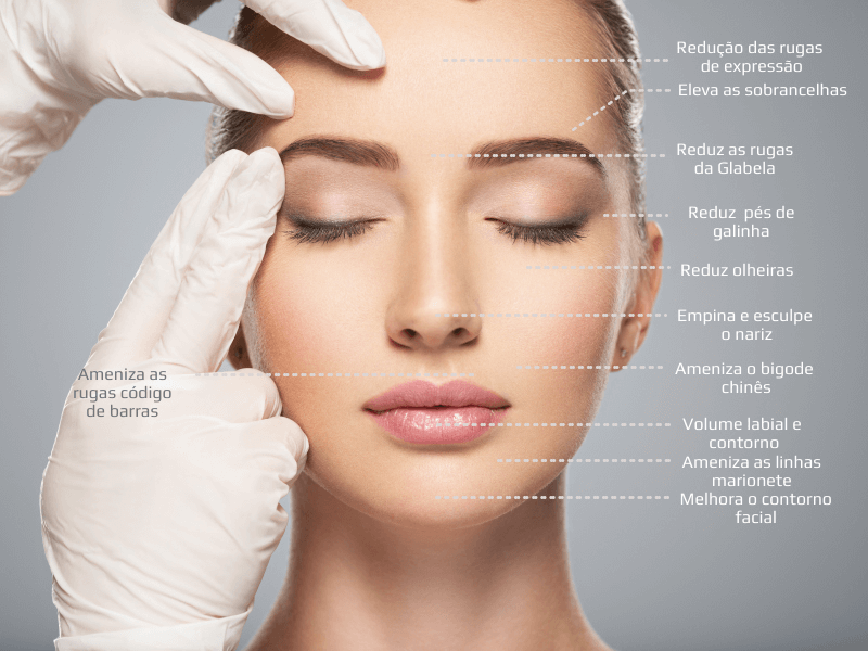benefícios da harmonização facial